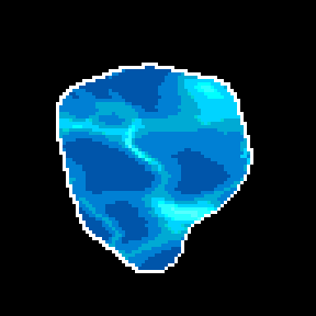 waterball
